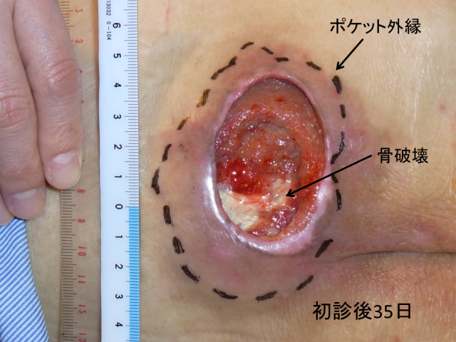 図11