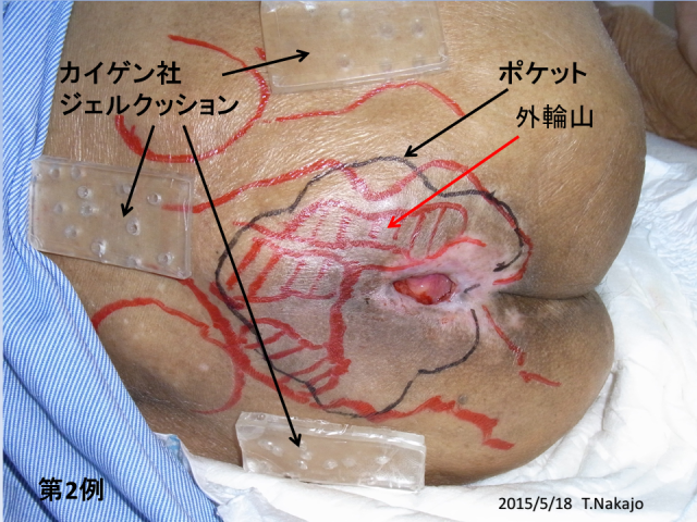 図22